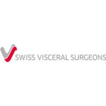 SVS